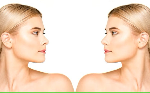 Debunking Myths About Face Lifting Devices: Separating Fact from Fiction